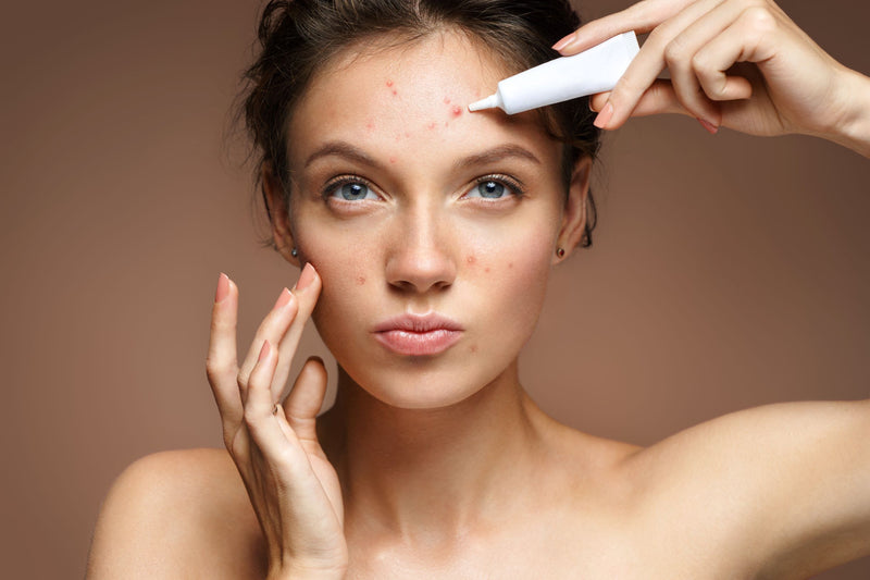 THOSE PESKY BREAKOUTS